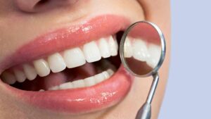 Broken or Cracked Tooth - Emergency Dentist | Dental Solution 24